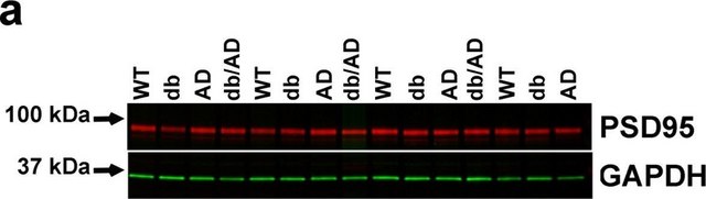 Anti-Glial Fibrillary Acidic Protein antibody produced in rabbit IgG fraction of antiserum, buffered aqueous solution