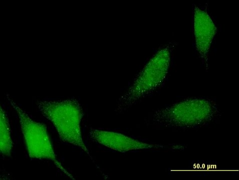 Monoclonal Anti-DIP13B antibody produced in mouse clone 1C10, purified immunoglobulin, buffered aqueous solution