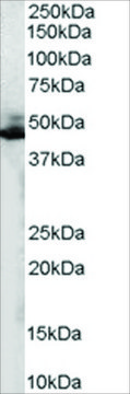 Anti-ADRB2R/ADRB2 antibody produced in goat affinity isolated antibody, buffered aqueous solution