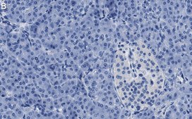 Anti-O-GlcNAc Transferase Antibody, clone 1O19 ZooMAb&#174; Rabbit Monoclonal recombinant, expressed in HEK 293 cells