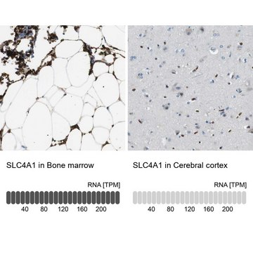 Anti-SLC4A1 antibody produced in rabbit Prestige Antibodies&#174; Powered by Atlas Antibodies, affinity isolated antibody, buffered aqueous glycerol solution