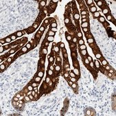 Anti-KRT20 antibody produced in rabbit Prestige Antibodies&#174; Powered by Atlas Antibodies, affinity isolated antibody, buffered aqueous glycerol solution, Ab1