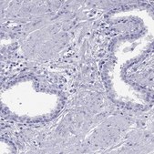 Anti-TSHB antibody produced in rabbit Prestige Antibodies&#174; Powered by Atlas Antibodies, affinity isolated antibody
