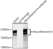 Anti-Neurofilament H Antibody, clone 7L2V7, Rabbit Monoclonal