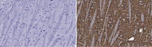 Anti-Synaptophysin Antibody, clone 1G7, ZooMAb&#174; Rabbit Monoclonal recombinant, expressed in HEK 293 cells