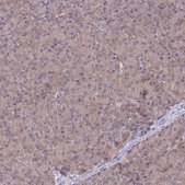 Anti-UBE2N antibody produced in rabbit Prestige Antibodies&#174; Powered by Atlas Antibodies, affinity isolated antibody, buffered aqueous glycerol solution