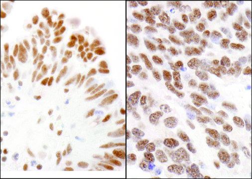 Rabbit anti-CBX3 Antibody, Affinity Purified Powered by Bethyl Laboratories, Inc.