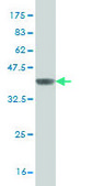 Monoclonal Anti-IRF4, (C-terminal) antibody produced in mouse clone 2D1, purified immunoglobulin, buffered aqueous solution