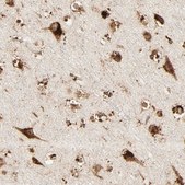 Anti-PSAP antibody produced in rabbit Prestige Antibodies&#174; Powered by Atlas Antibodies, affinity isolated antibody, buffered aqueous glycerol solution