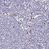 Anti-TLR4 antibody produced in rabbit Prestige Antibodies&#174; Powered by Atlas Antibodies, affinity isolated antibody, buffered aqueous glycerol solution