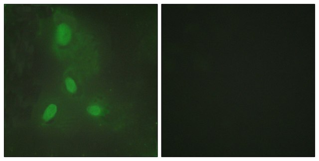 Anti-BACH1 antibody produced in rabbit affinity isolated antibody