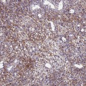 Anti-ABCA8 antibody produced in rabbit Prestige Antibodies&#174; Powered by Atlas Antibodies, affinity isolated antibody, buffered aqueous glycerol solution