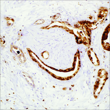 S100P (16/f5) Mouse Monoclonal Antibody