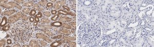 Anti-TSC2 Antibody, clone 4H10 ZooMAb&#174; Rabbit Monoclonal recombinant, expressed in HEK 293 cells