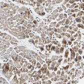 Anti-RHOT2 antibody produced in rabbit Prestige Antibodies&#174; Powered by Atlas Antibodies, affinity isolated antibody, buffered aqueous glycerol solution