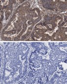 Anti-Beclin 1 Antibody, clone 1E22 , ZooMAb&#174; Rabbit Monoclonal recombinant, expressed in HEK 293 cells