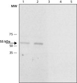 Anti-Calsequestrin-2 antibody produced in rabbit ~1.0&#160;mg/mL, affinity isolated antibody, buffered aqueous solution