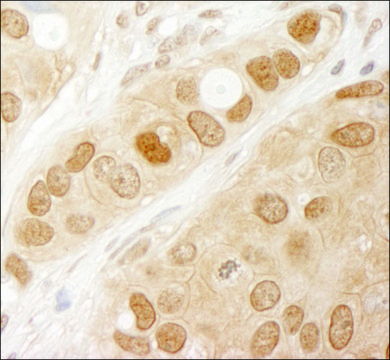 Rabbit anti-AKT1 Antibody, Affinity Purified Powered by Bethyl Laboratories, Inc.