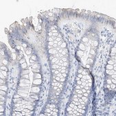 Anti-MUC17 antibody produced in rabbit Prestige Antibodies&#174; Powered by Atlas Antibodies, affinity isolated antibody, buffered aqueous glycerol solution