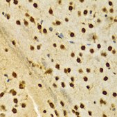 Anti-HNRNPA2B1 antibody produced in rabbit