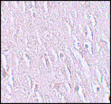 Anti-ZBTB5 antibody produced in rabbit affinity isolated antibody, buffered aqueous solution