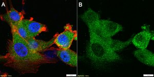 Anti-CH25H Antibody, clone 1G14 ZooMAb&#174; Rabbit Monoclonal recombinant, expressed in HEK 293 cells