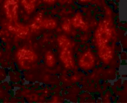 Anti-TRIM5 alpha antibody produced in rabbit affinity isolated antibody