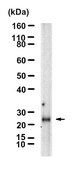 Anti-IL-5 Antibody, clone 1B20 ZooMAb&#174; Rabbit Monoclonal recombinant, expressed in HEK 293 cells