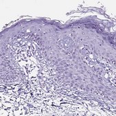 Anti-NPHS2 antibody produced in rabbit Prestige Antibodies&#174; Powered by Atlas Antibodies, affinity isolated antibody, buffered aqueous glycerol solution
