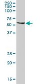 Anti-TXNRD1 antibody produced in mouse IgG fraction of antiserum, buffered aqueous solution