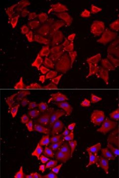 Anti-TIMM17A antibody produced in rabbit