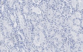 Anti-Claudin 6 Antibody, clone 1B22 ZooMAb&#174; Rabbit Monoclonal recombinant, expressed in HEK 293 cells