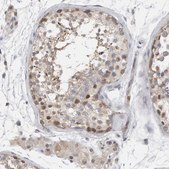 Anti-MSRA antibody produced in rabbit Prestige Antibodies&#174; Powered by Atlas Antibodies, affinity isolated antibody, buffered aqueous glycerol solution