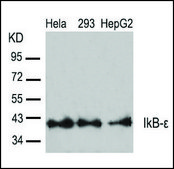 Anti-NFKBIE (Ab-22) antibody produced in rabbit affinity isolated antibody