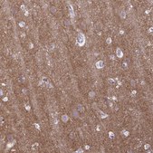 Anti-GABBR2 antibody produced in rabbit Prestige Antibodies&#174; Powered by Atlas Antibodies, affinity isolated antibody, buffered aqueous glycerol solution