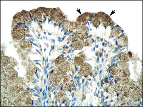 Anti-NCOR1 antibody produced in rabbit affinity isolated antibody