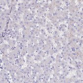 Anti-SLC26A4 antibody produced in rabbit Prestige Antibodies&#174; Powered by Atlas Antibodies, affinity isolated antibody, buffered aqueous glycerol solution