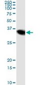 Monoclonal Anti-NNMT antibody produced in mouse clone 2F2, purified immunoglobulin, buffered aqueous solution