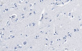 Anti-BDNF Antibody, clone 1I14 ZooMAb&#174; Rabbit Monoclonal recombinant, expressed in HEK 293 cells