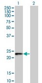 Monoclonal Anti-FBXO36 antibody produced in mouse clone 3D3, purified immunoglobulin, buffered aqueous solution