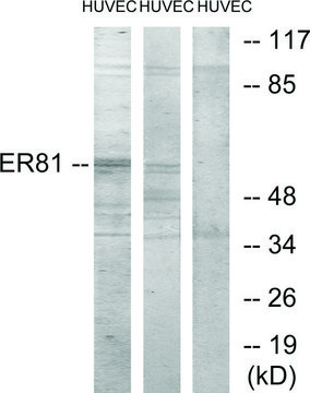 Anti-ER81 antibody produced in rabbit affinity isolated antibody