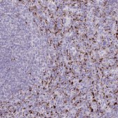 Anti-LIPA antibody produced in rabbit Prestige Antibodies&#174; Powered by Atlas Antibodies, affinity isolated antibody, buffered aqueous glycerol solution