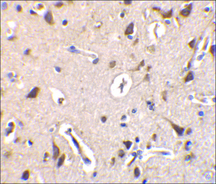 Anti-ILPIP antibody produced in rabbit affinity isolated antibody, buffered aqueous solution