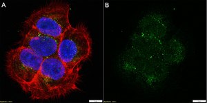 Anti-Presenilin-1 Antibody, clone PS1-loop ZooMAb&#174; Mouse Monoclonal recombinant, expressed in HEK 293 cells