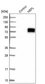 Anti-NEFL antibody produced in rabbit Prestige Antibodies&#174; Powered by Atlas Antibodies, affinity isolated antibody, buffered aqueous glycerol solution