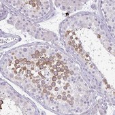 Anti-SPAG1 antibody produced in rabbit Prestige Antibodies&#174; Powered by Atlas Antibodies, affinity isolated antibody, buffered aqueous glycerol solution