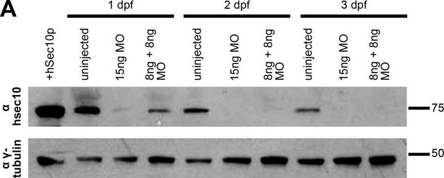 Anti-&#947;-Tubulin antibody produced in rabbit affinity isolated antibody, buffered aqueous solution