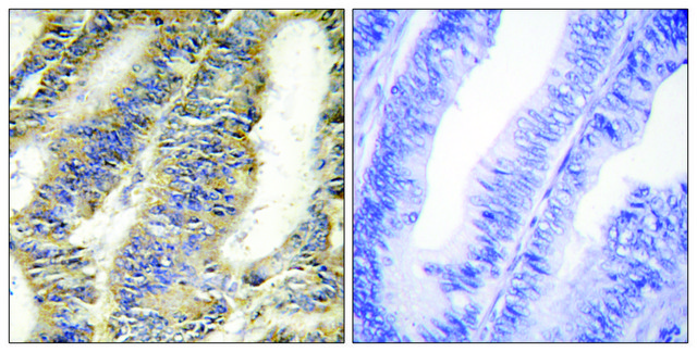 Anti-TNFA antibody produced in rabbit affinity isolated antibody