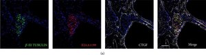 Monoclonal Anti-&#946;-Tubulin III antibody produced in mouse clone SDL.3D10, ascites fluid