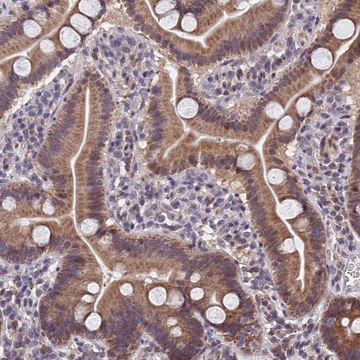 Anti-CYP2R1 antibody produced in rabbit Prestige Antibodies&#174; Powered by Atlas Antibodies, affinity isolated antibody, buffered aqueous glycerol solution